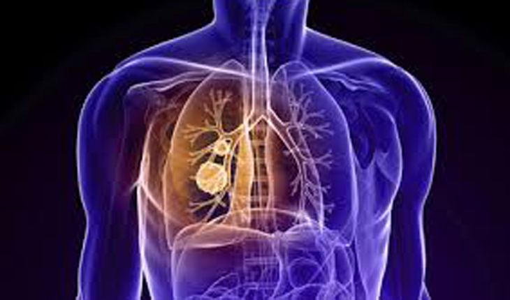 ফুসফুস ভালো রাখবে যেসব খাবার