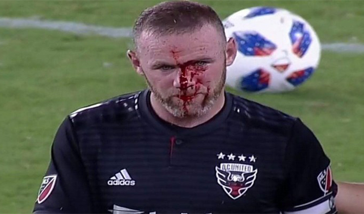 প্রতিপক্ষ খেলোয়াড়ের সঙ্গে সংঘর্ষে নাক ফে