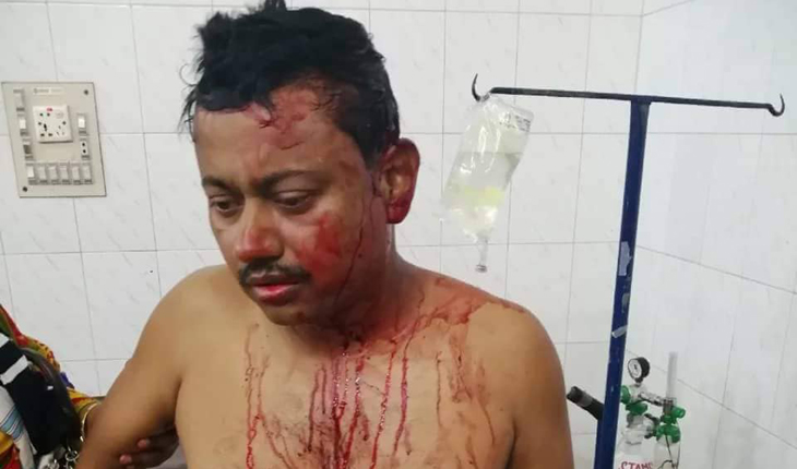 গাজীপুরে সন্ত্রাসীদের হামলায় আহত এক