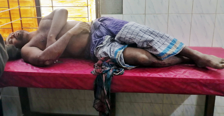 ভোট চাইতে গিয়ে হামলায় উভয় পক্ষের পাঁচ না